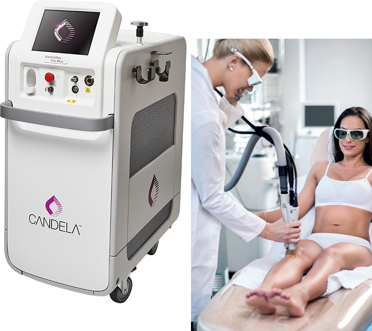 Candela Laser Pro Plus