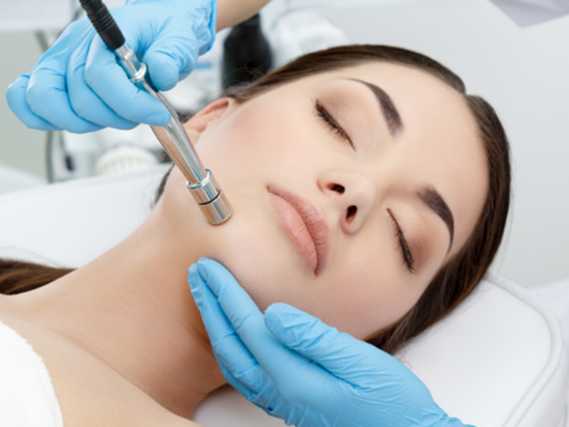 Microneedling
