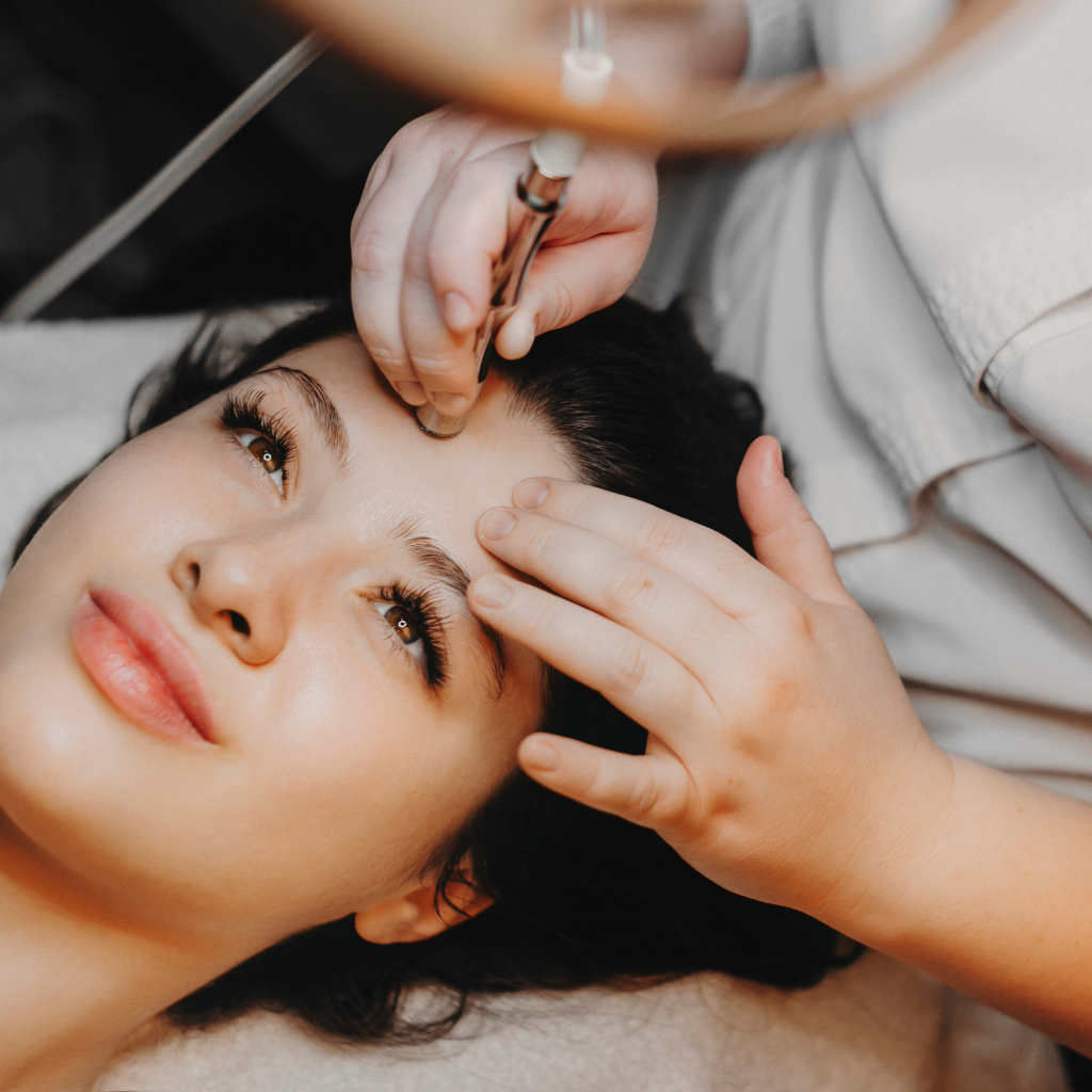 Microneedling Image
